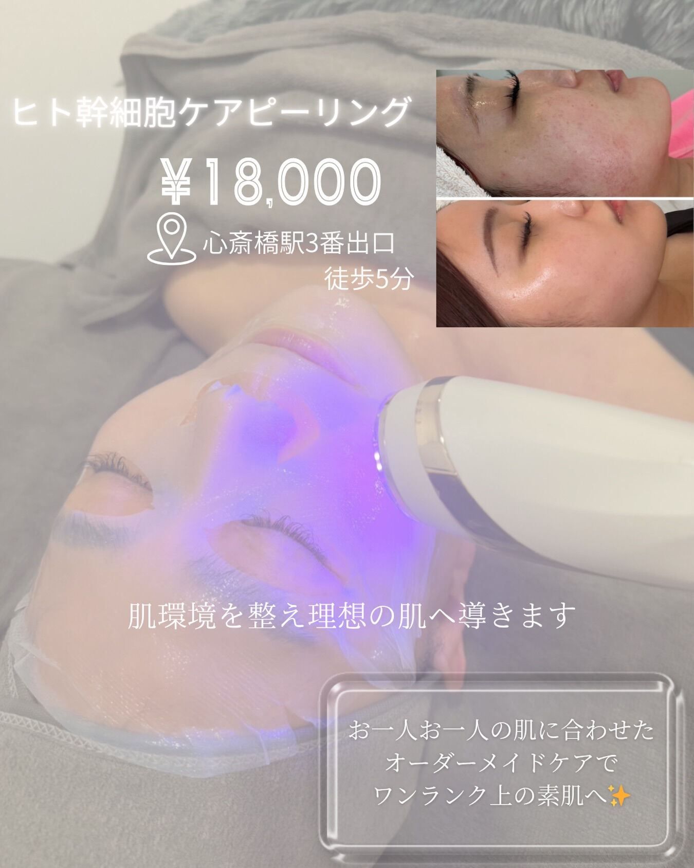 Queenbee Salonではお一人お一人のお肌に合わせた