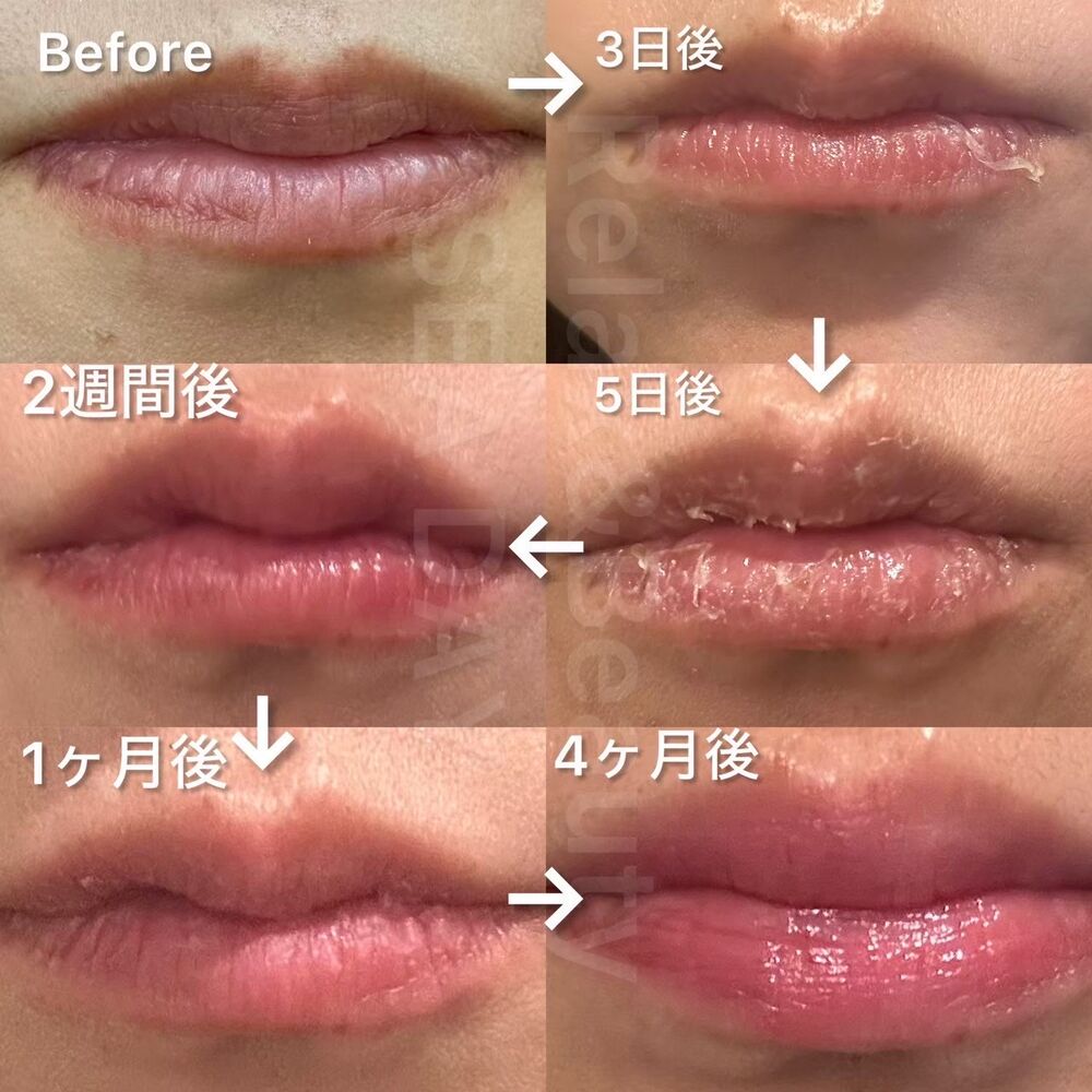 画像6394